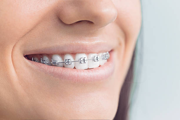 Best Teeth Whitening  in Salem, IL